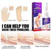 South Moon Chicken Eye Lotion Extra Clear s Skin Care Chicken es Foot Pad Gram Warts